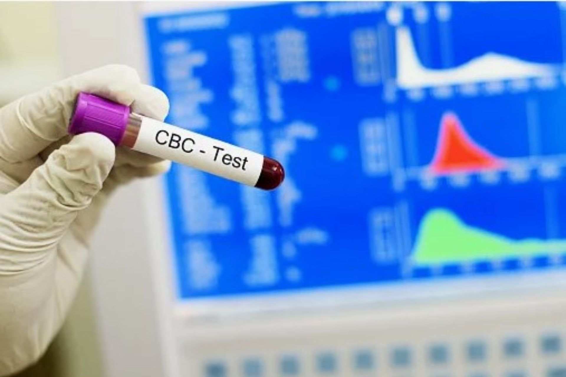 CBC test price in Bangladesh